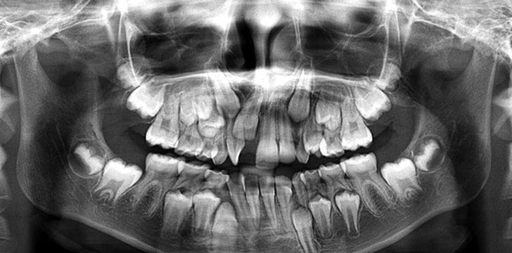 You can grow more than 200 teeth thanks to an odotoma!