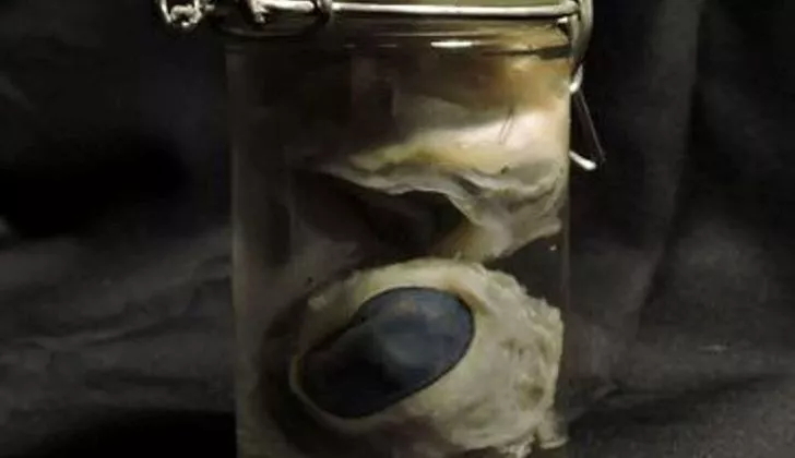 A jar containing two pickled sheep eyes