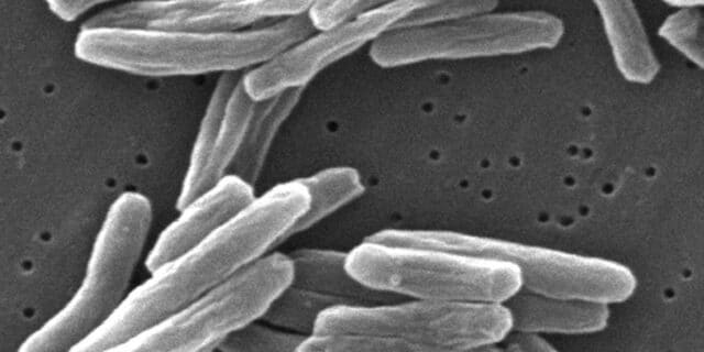 OTD in 1882: Dr. Robert Koch discovered Mycobacterium Tuberculosis which is bacteria that causes tuberculosis (TB).