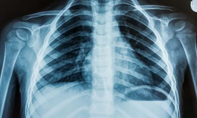 OTD in 1896: College students illegally produced the very first X-ray photo.