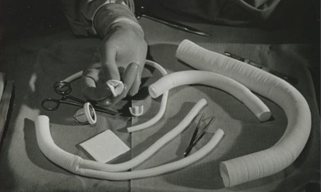 OTD in 1982: The first artificial heart was successfully implanted.