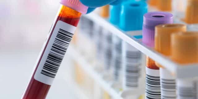 OTD in 1935: New York became the first US court to allow blood test results to be used as evidence.