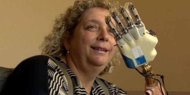 OTD in 2018: A woman in Rome became the first person to receive a bionic hand that can sense touch.