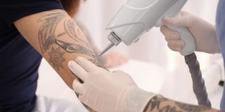 August 14: National Tattoo Removal Day