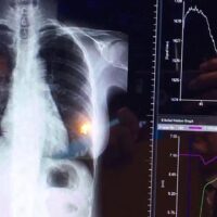 November 8: World Radiography Day