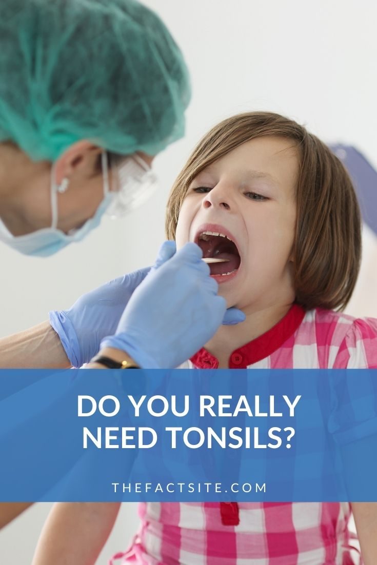 Do You Really Need Tonsils?