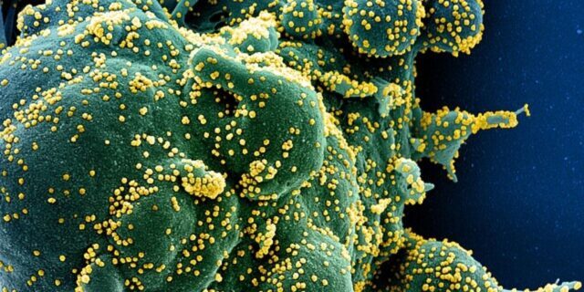 OTD in 2019: A 55-year-old man became the first known person to contract COVID-19.