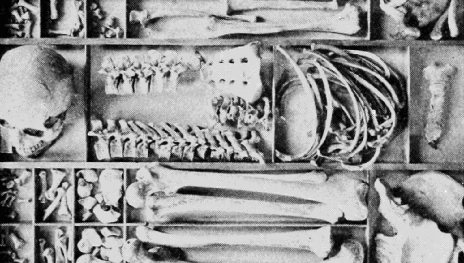 A human skeleton in a box