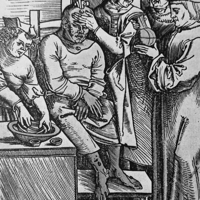 Medieval woodcut showing doctors examining a man with visible skin lesions on his face and legs