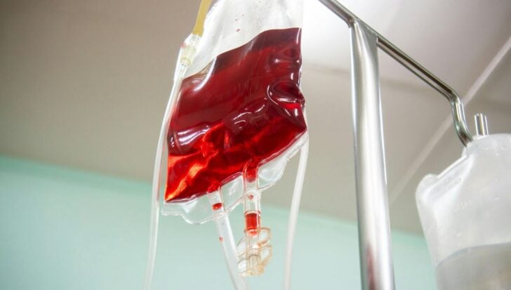 Blood donation bag suspended on a metal stand